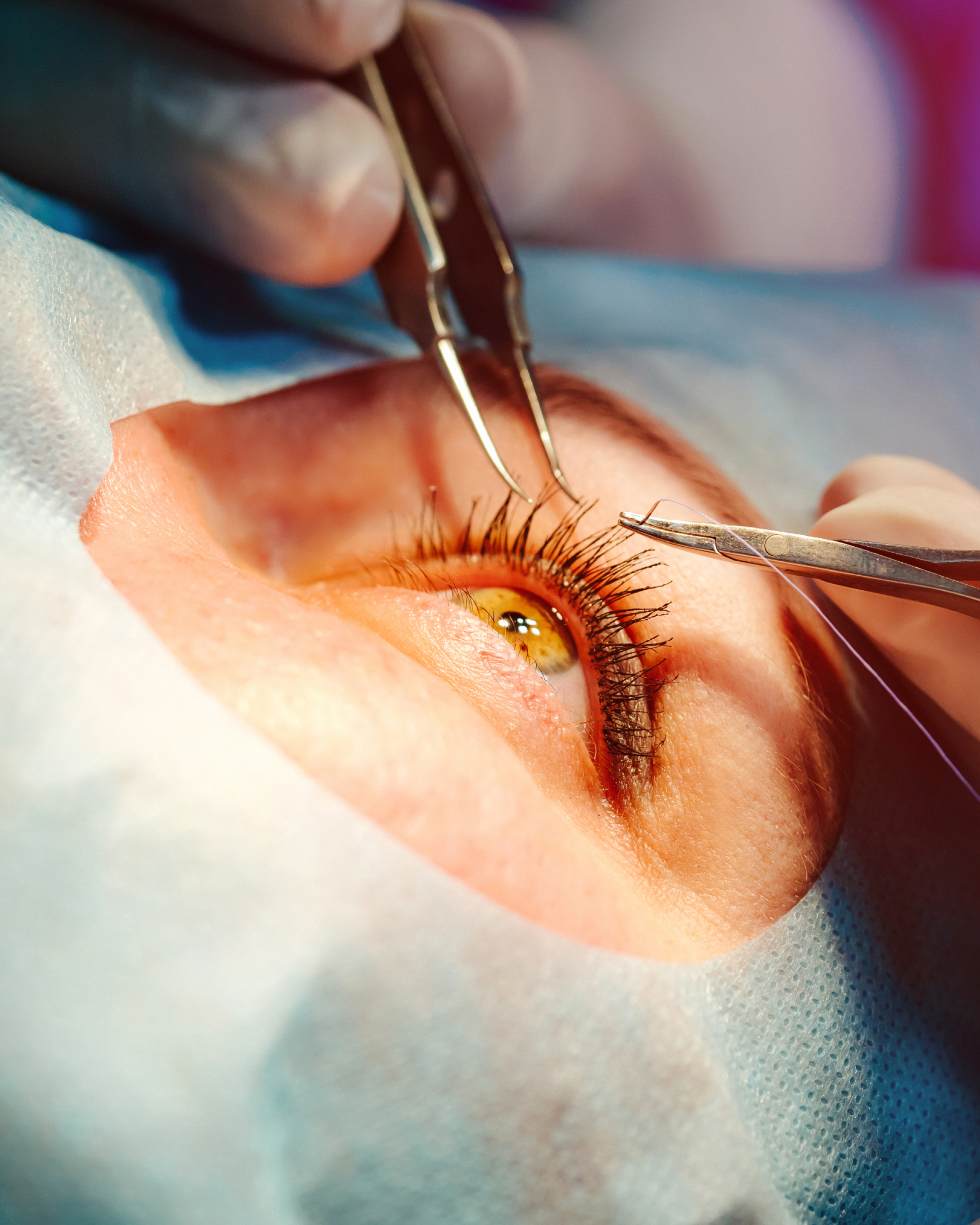 Consultant-led glaucoma medical management to protect vision at The Eye Doctor Clinic in Huddersfield